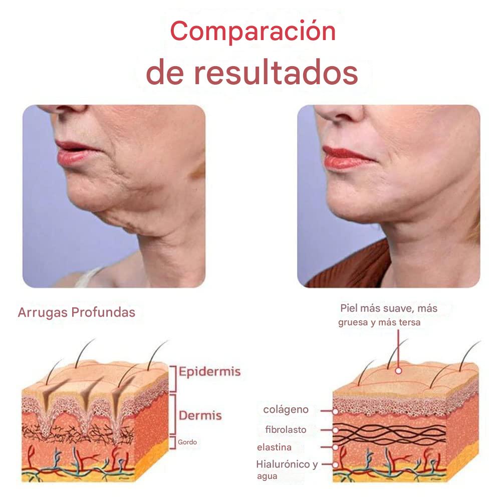 Pibamy™ Suero Eliminador de manchas oscuras al 5% de Niacinamida