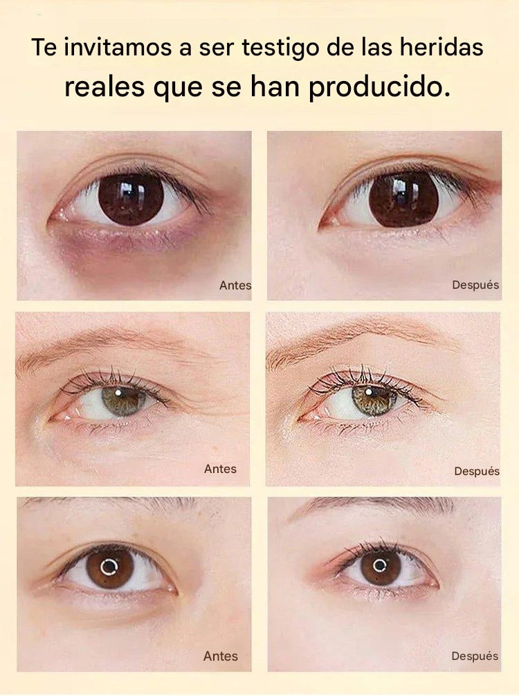 X40 Mascarilla Hidratante Profunda y Nutritiva de Caracol para ojos Limpieza facial Cuidado de la piel