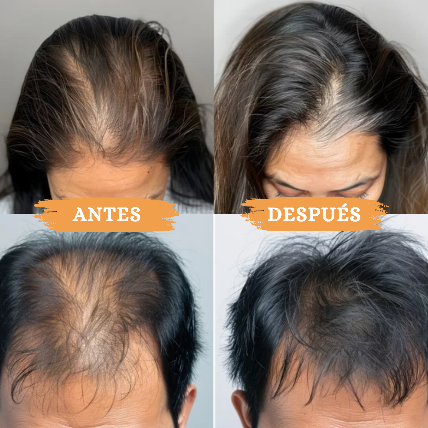 Tónico Capilar Spray Ginseng OUHOE®