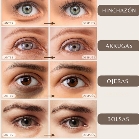 x6 Mascarillas Hidratante Ácido Kójico Limpieza facial Cuidado de la piel