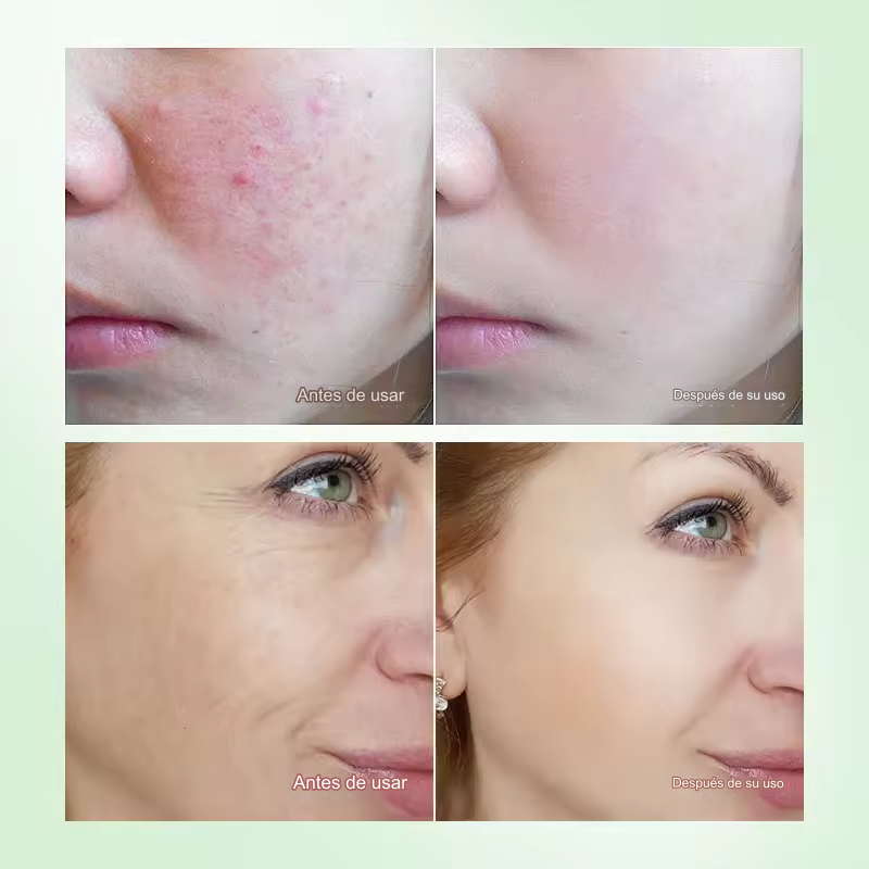 Youthful Glow Ferulic Serum: Neutraliza el Enrojecimiento y Rejuvenece tu Piel con Potentes Antioxidantes