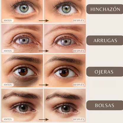 x6 Mascarillas Hidratante Ácido Kójico Limpieza facial Cuidado de la piel